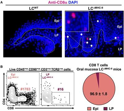 MHC-II presentation by oral Langerhans cells impacts intraepithelial Tc17 abundance and Candida albicans oral infection via CD4 T cells